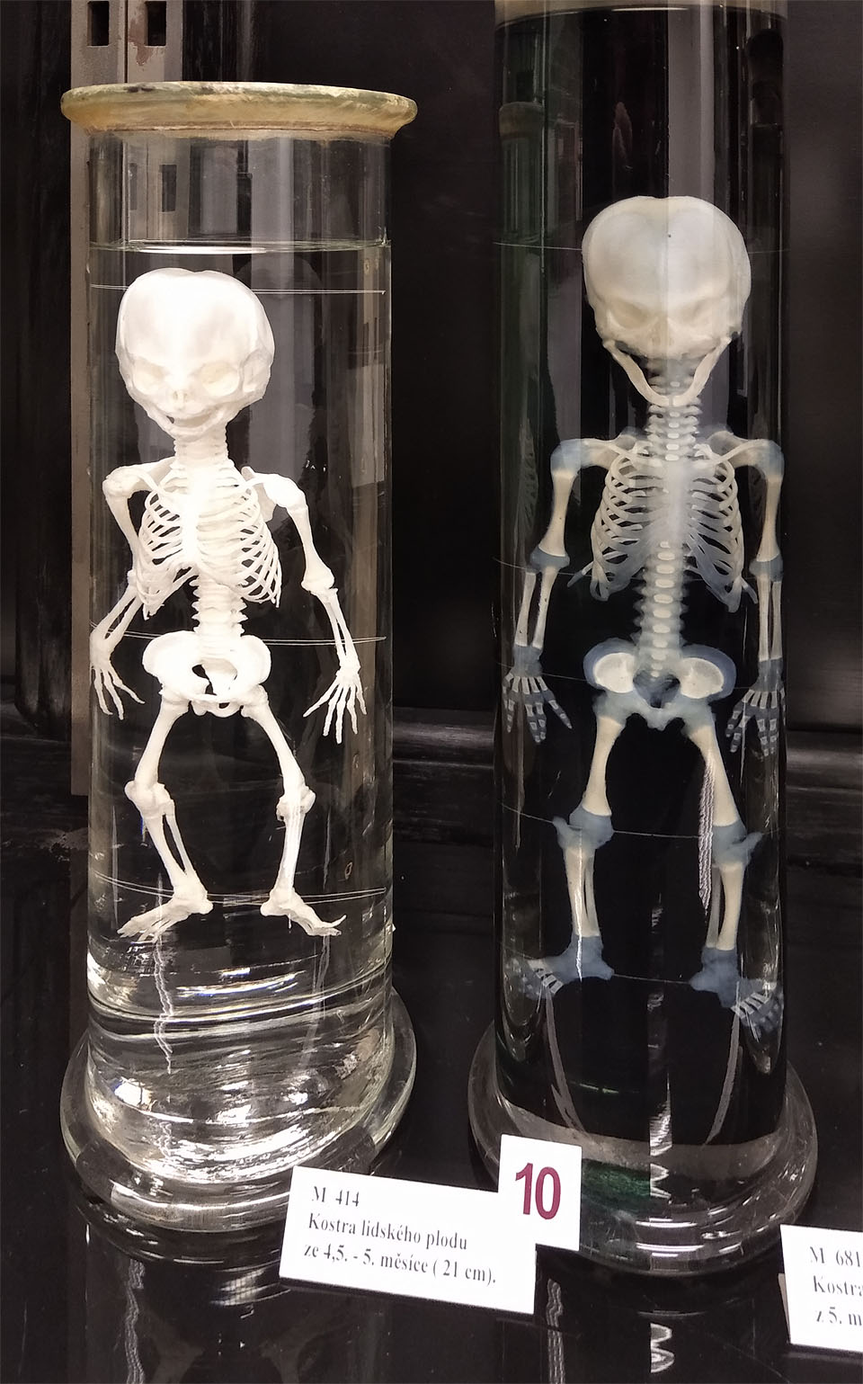 V Anatomickém muzeum prof. Karla Žlábka jsme byli před šestou hodinou prakticky sami. Některé exponáty byly docela děsivé.